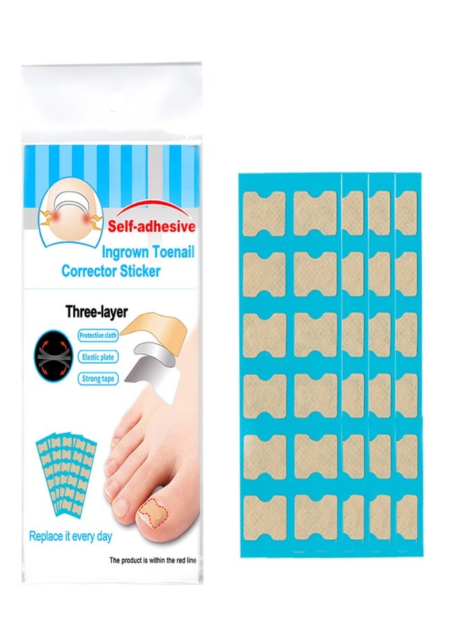 Ingrown Toenail Corrector Stickers Foot Care Stickers Non Glue Toenail Patch Adhesive Toenail Correction Pedicure Toe Nail Treatment Elastic Patch Sticker Blue Stick Bars - Image 3