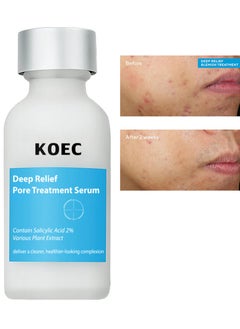 KOEC 2% Salicylic Acid Facial Deep Relief Pore Treatment Serum for Acne,Blackheads,Enlarged Pores,Improves Skin Texture and Reduces Oil,Contain Various Plant Extract 30ml Unisex  - Image 1