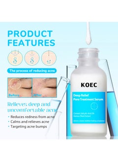 KOEC 2% Salicylic Acid Facial Deep Relief Pore Treatment Serum for Acne,Blackheads,Enlarged Pores,Improves Skin Texture and Reduces Oil,Contain Various Plant Extract 30ml Unisex  - Image 4