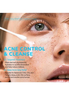 KOEC 2% Salicylic Acid Facial Deep Relief Pore Treatment Serum for Acne,Blackheads,Enlarged Pores,Improves Skin Texture and Reduces Oil,Contain Various Plant Extract 30ml Unisex  - Image 3