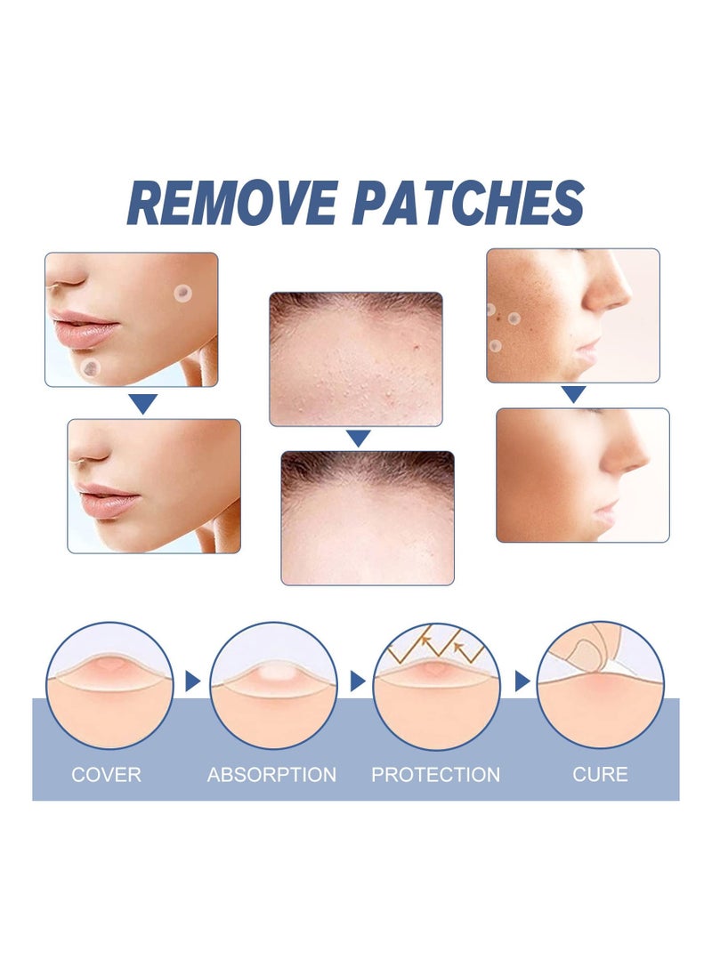 Y&D Remover Patches, Removal Kit, Fast and Easy Operate Skin Home Tool, Flesh Nevus Black Lightening Agent Patch, Safe & Painless(144Pcs)  - Image 4