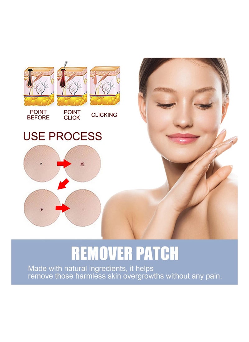 Y&D Remover Patches, Removal Kit, Fast and Easy Operate Skin Home Tool, Flesh Nevus Black Lightening Agent Patch, Safe & Painless(144Pcs)  - Image 2