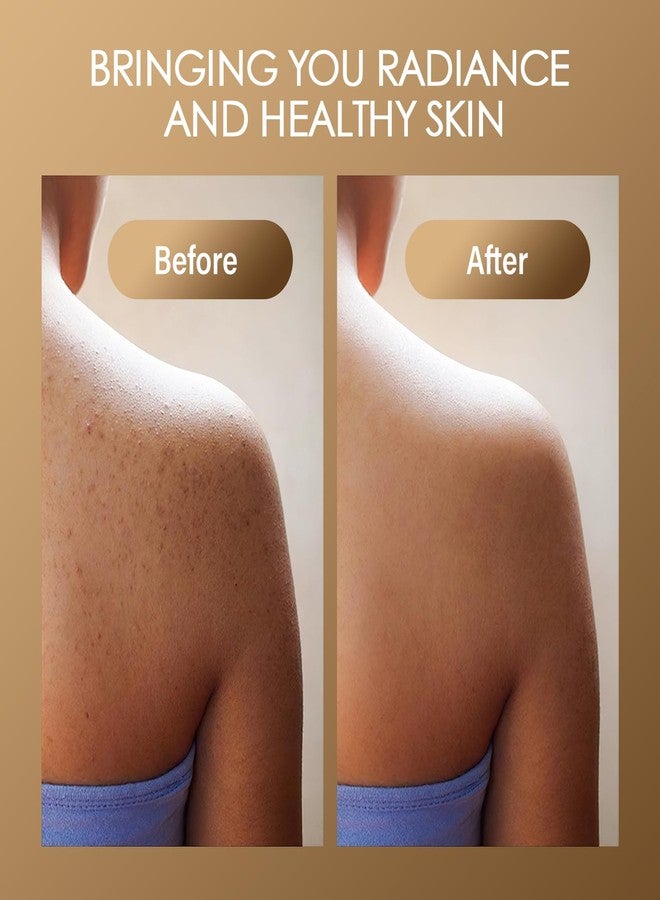 MOSRROU Turmeric Body Scrub Vitamin C Exfoliating Body Scrub With Collagen And Coconut Oil Body Exfoliator Dead Skin Remover Smooth And Hydrated Natural Scrub For Butt Bikini Area With Loofah - Image 4