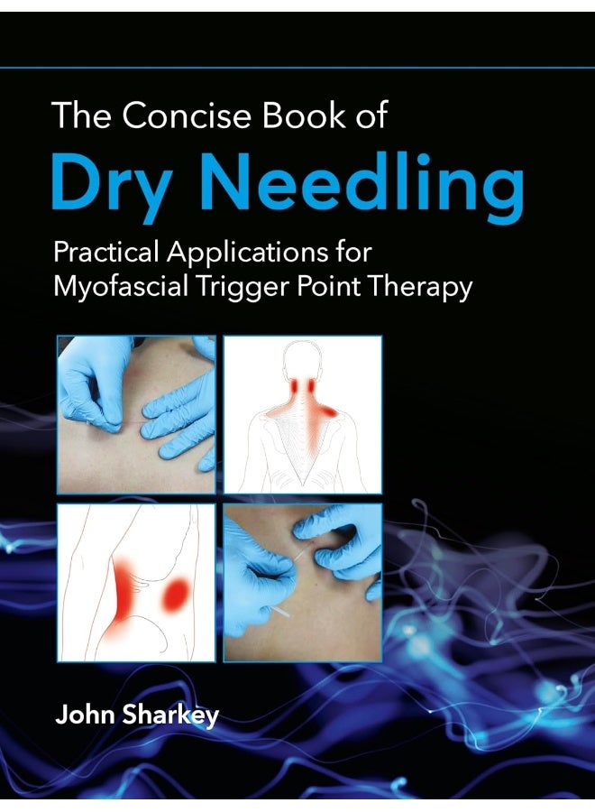 The Concise Book of Dry Needling: A Practitioner's Guide to Myofascial Trigger Point Applications  - Image 1