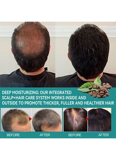 EELHOE Hair Growth Serum - Biotin Hair Regrowth Oil Prevent Hair Loss and Helps Hair Thicker, Stronger, Longer Hair Treatment Men and Women (45 ML)  - Image 2