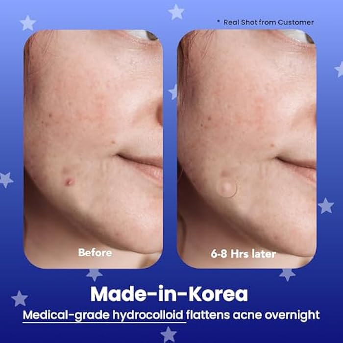 AVARELLE Spot Pimple Patches for Face | Good Night Acne Cover | Hydrocolloid with Tea Tree Oil | Acne Spot Treatment (12-14 mm, 24 ct) - Image 2
