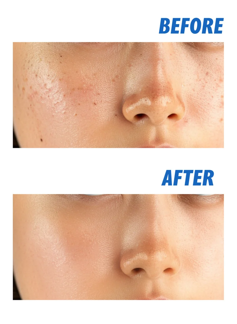 nightingale Korean ECTO Hyaluronic Face Cream 100ml - Deeply Moisturizing with Ectoin