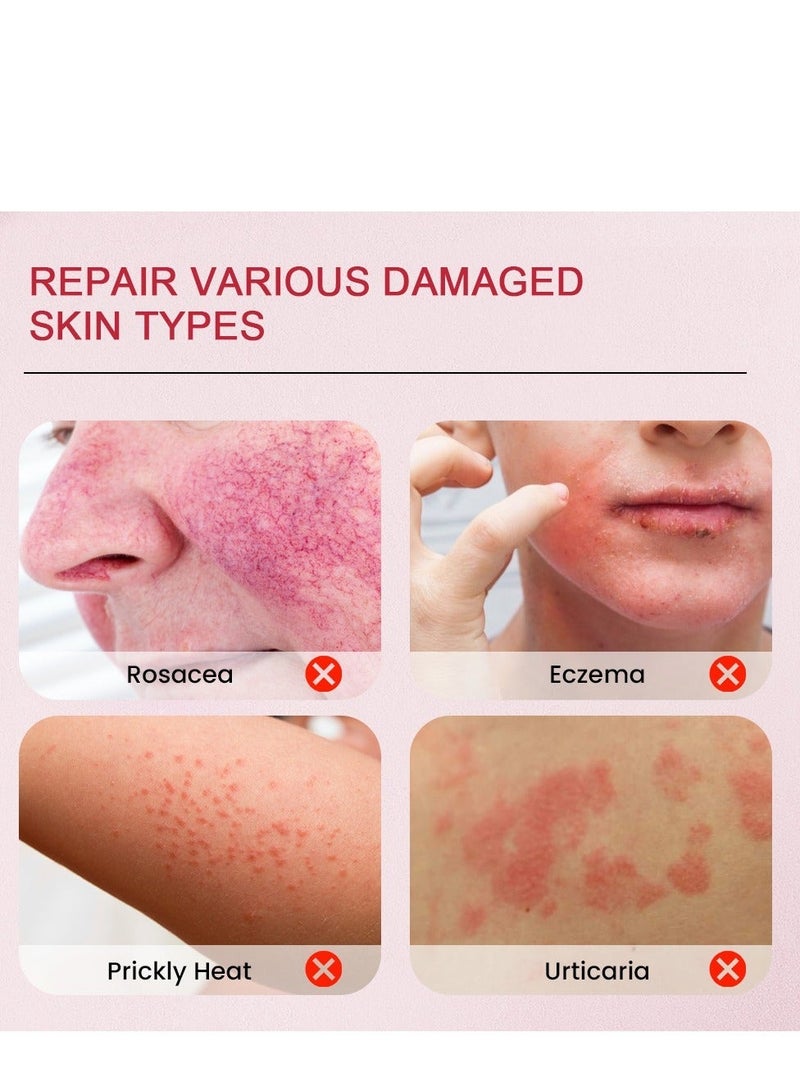 Sumifun Extra Strength Calamine Eczema Relief Cream, Promote Skin Health, Effective Relieve Itchy Inflamed ,Relieve Rosacea Vs Eczema Nourishing  Repairing Skin 20g - Image 2