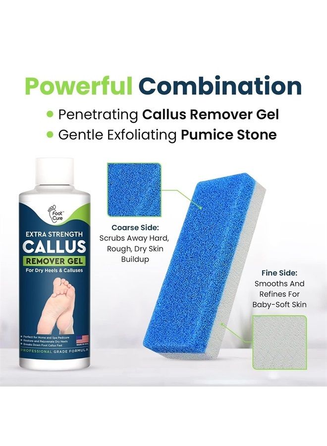 Callus Remover for Feet with Extra Strength Gel & Foot Pumice Stone Set - Easy Way to Remove Hard Calluses & Dead Skin Build-Up - Professional At-Home Foot Care for Men & Women - Made in the USA
