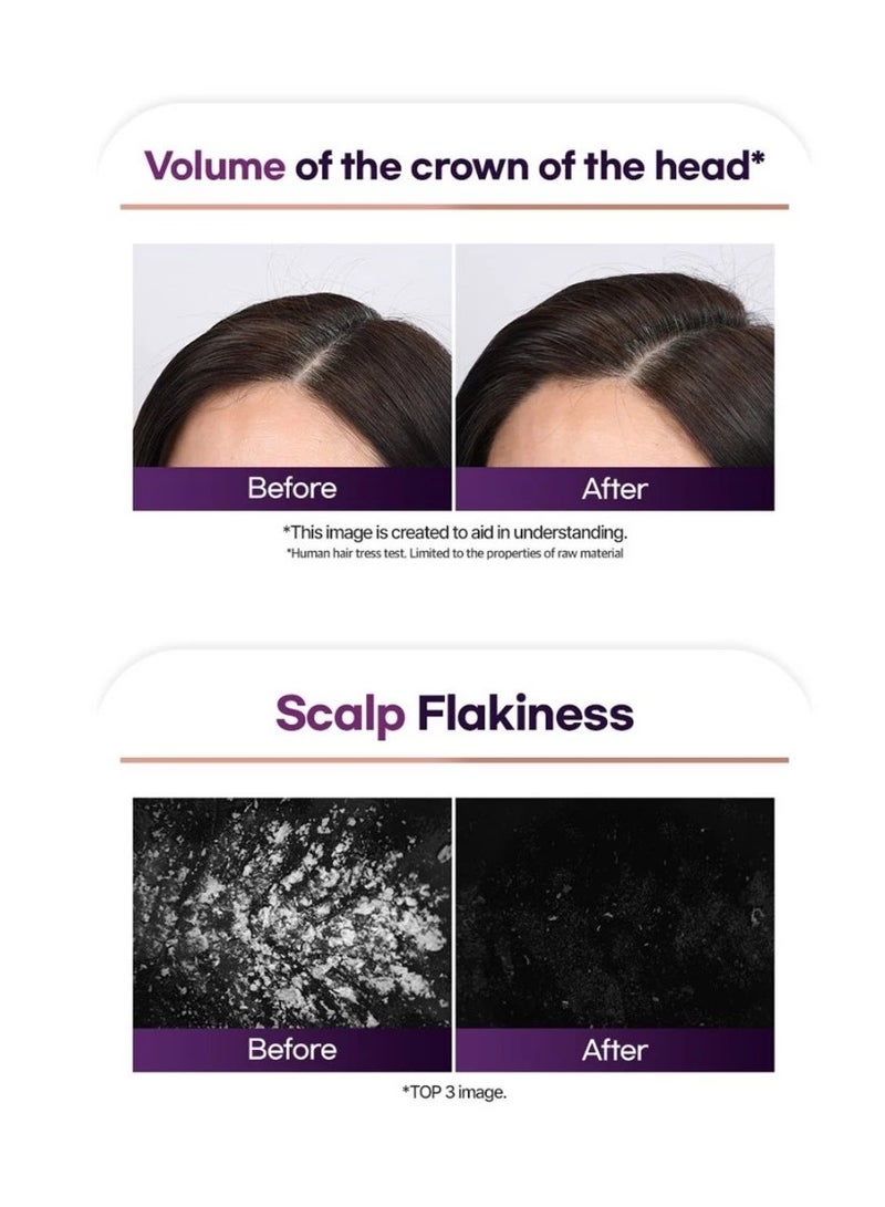 Ryo Hair Loss Care Super Value Set - Image 3