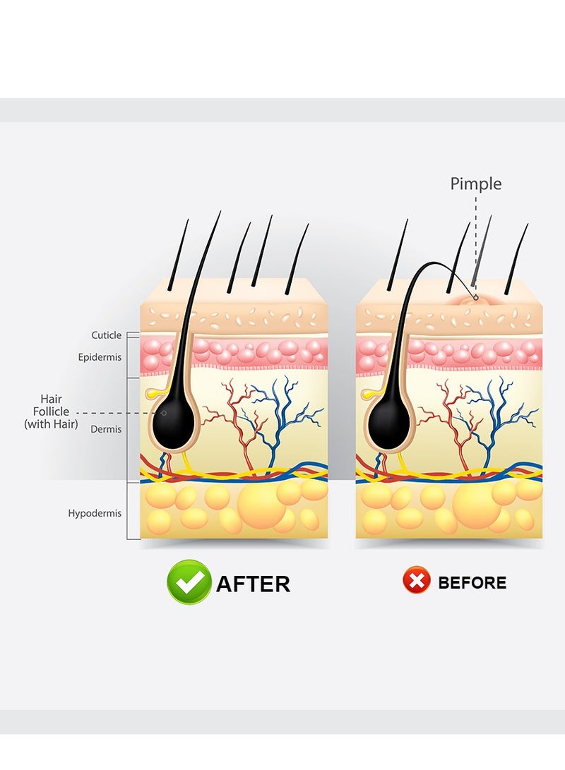 سوميفون مرهم مهدئ لبصيلات الشعر - كريم مغذي 20 جرام للبشرة المصابة بالحكة والالتهابات ، والعناية اللطيفة ببصيلات الشعر ، ويعزز نمو الشعر الصحي ، ويرطب ويقوي خط الشعر - Image 5