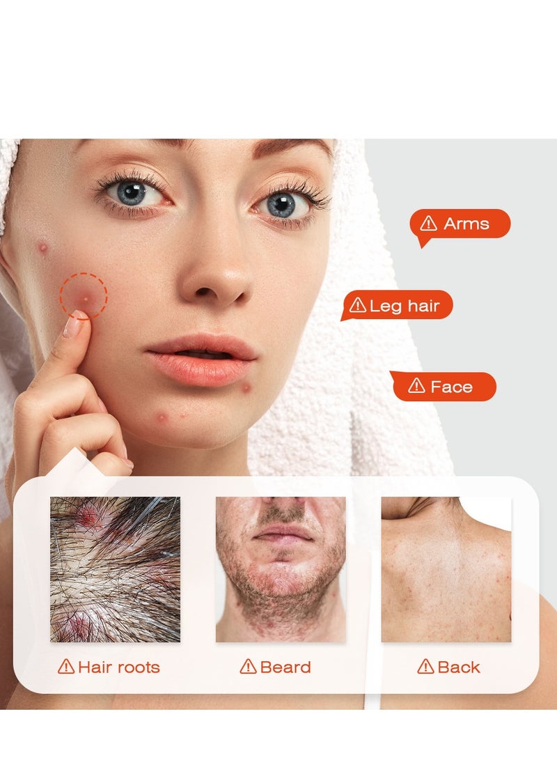 سوميفون مرهم مهدئ لبصيلات الشعر - كريم مغذي 20 جرام للبشرة المصابة بالحكة والالتهابات ، والعناية اللطيفة ببصيلات الشعر ، ويعزز نمو الشعر الصحي ، ويرطب ويقوي خط الشعر - Image 3