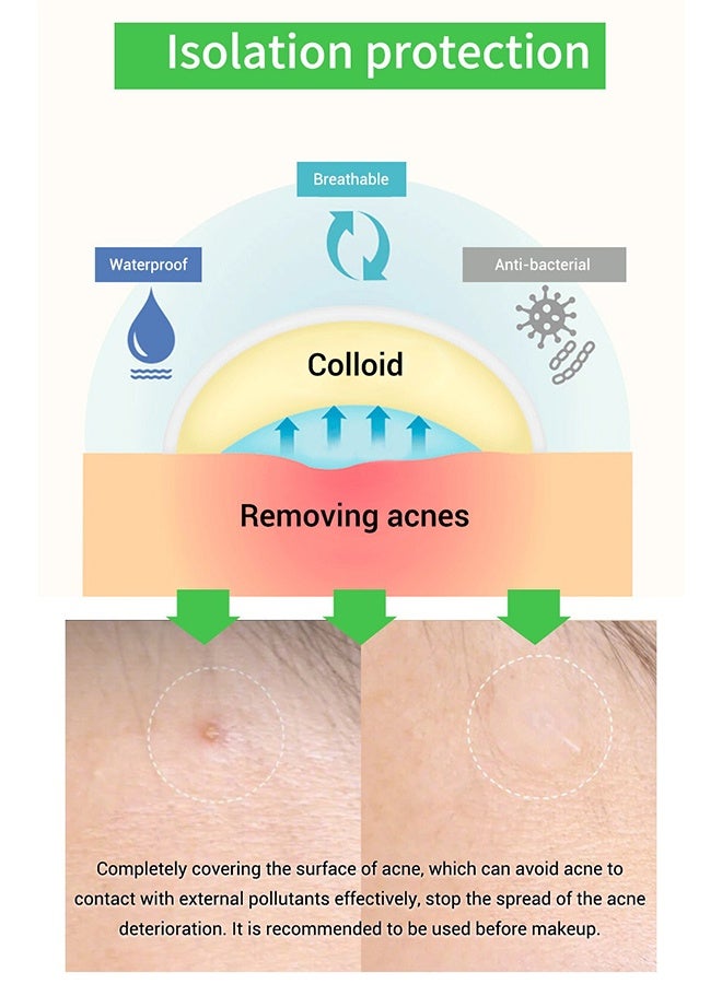 Breylee 22PCS Invisible Acne Patch for Night Care – Ultra Thin Hydrocolloid Pimple Patch for Fast Healing, Waterproof Spot Treatment for Face - Image 4