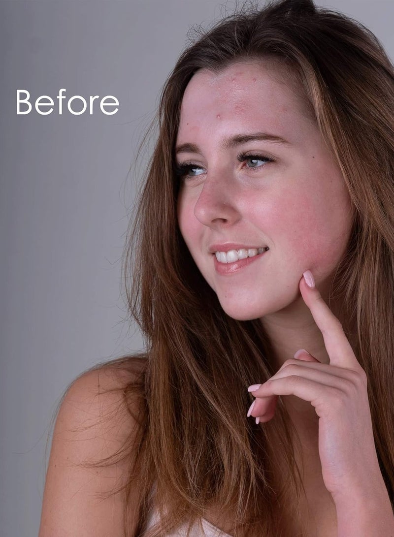 Nature Spell Detox Face Mask 100g – Activated Charcoal + Honey + Vitamin E – Deep Cleanse - Image 4