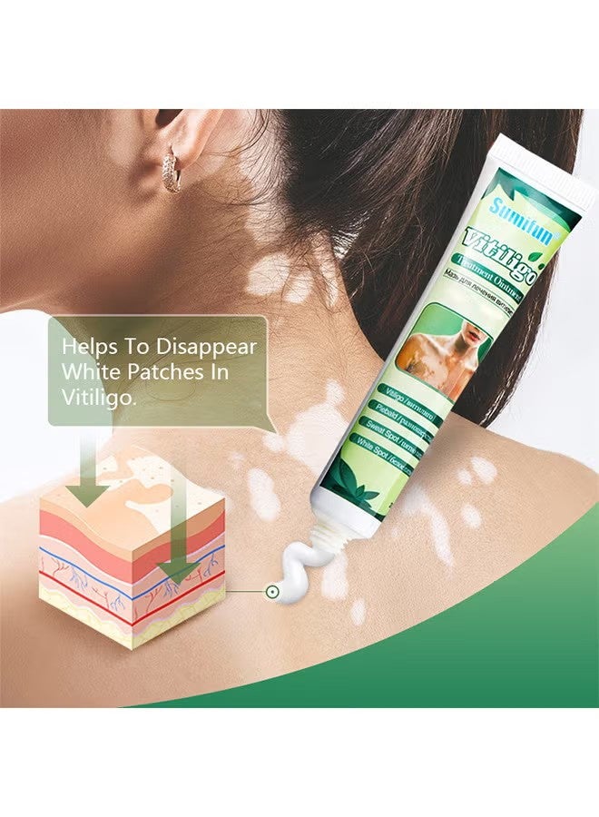 سوميفون مرهم علاج البهاق ، يقلل من البقع البيضاء على الجلد ، ينظم التصبغ ، يحسن تصبغ الجلد ، يقلل من البقع البيضاء على الجلد والبهاق كريم للعناية بالبشرة ، 20 جرام - Image 5