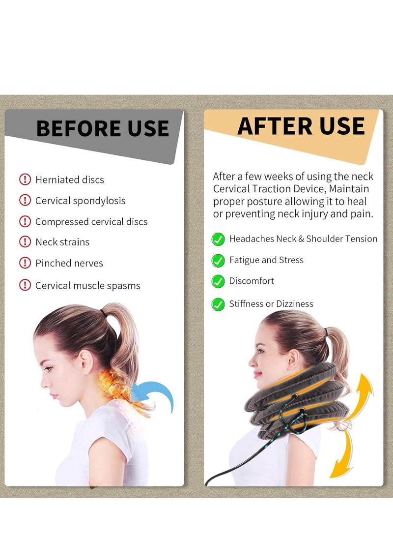 Cool Baby - COOLBABY Neck Stretcher Cervical Neck Traction Device for Neck Pain Relief - Inflatable Neck Traction Device & Cervicorrect Neck Brace for Home Use (Gray) - Image 1