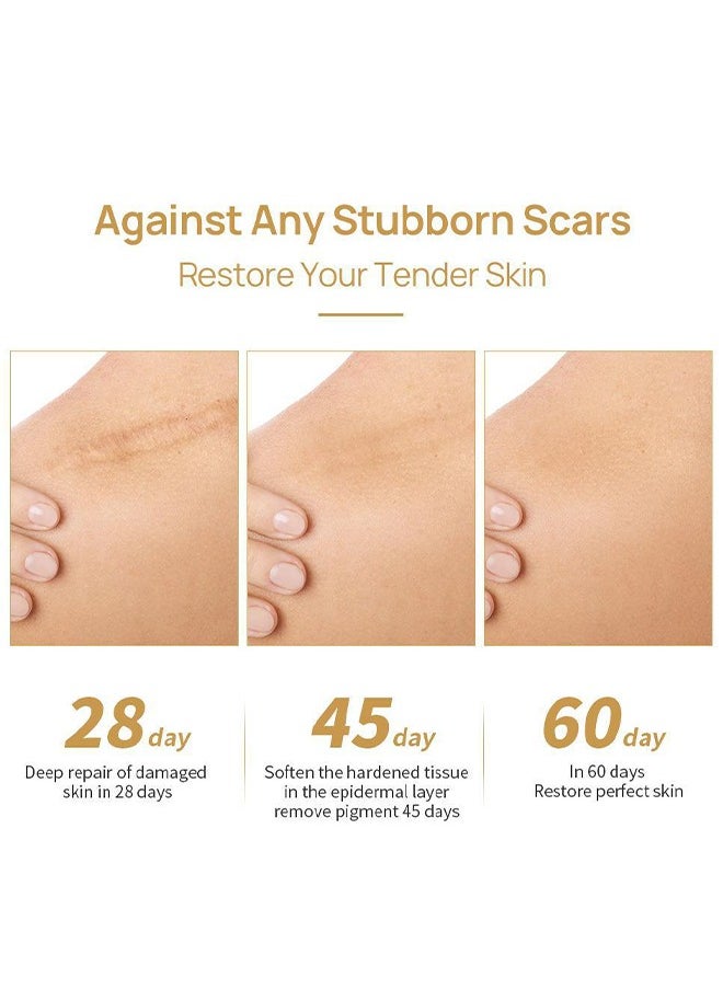 Skin Care Gel, Herbal repair scar cream 30g, scar gel, skin repair gel, natural plant ingredients, effectively repair old and new scars, burns, stretch marks, acne, sunburn, 30g