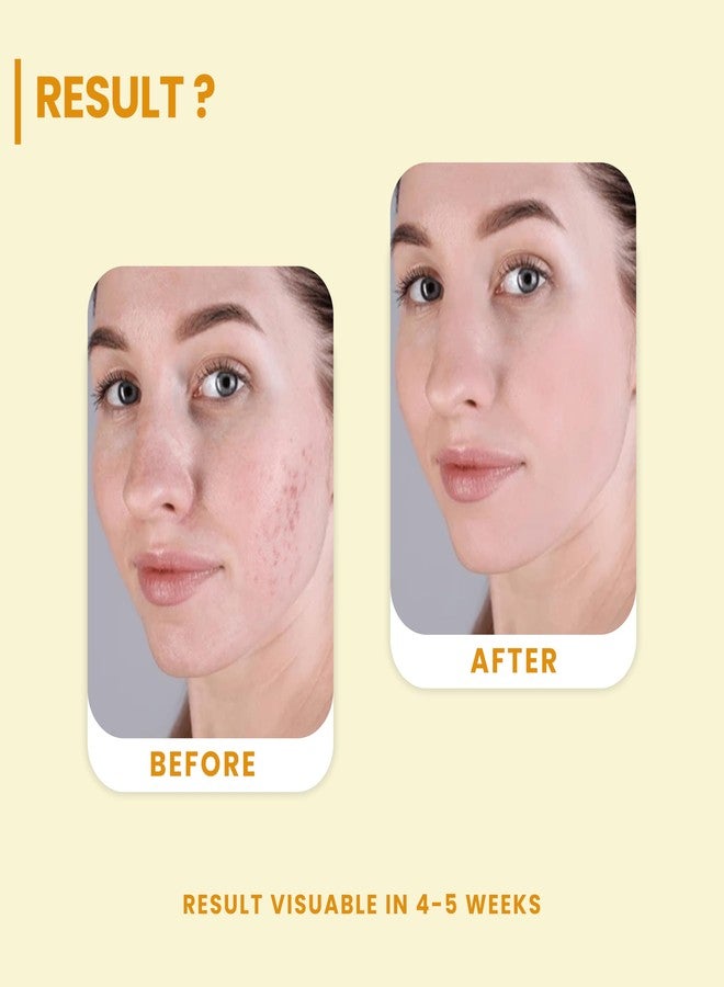 Ayumcure Vitamin C Combo Pack | 3% Niacinamide + 15% Vitamin C, Vitamin E & Hyaluronic Acid | Tightens Pores, Boosts Glow & Brightens Skin | All Skin Types | 200ml Toner + 30ml Serum | Men & Women - Image 4