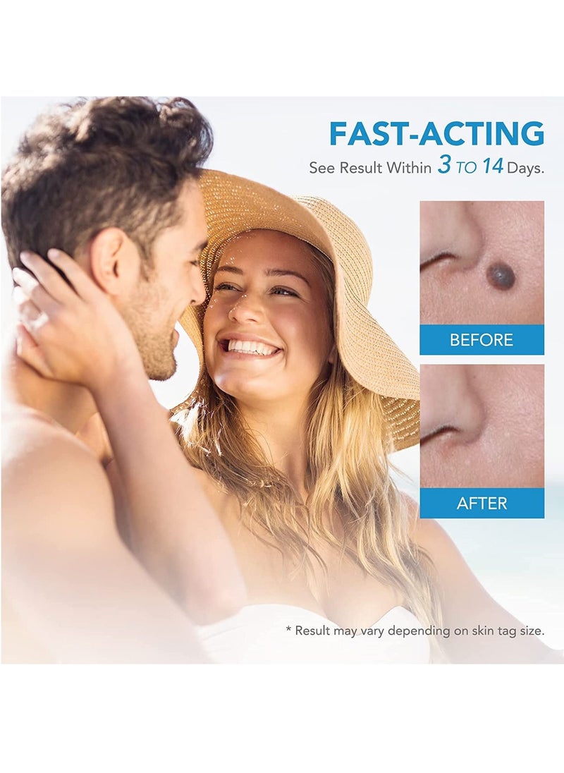 SYOSI - Skin Tag Remover, Auto Painless Skin Tag Remover Device for Small to Large Sized Skin Tags (2mm-8mm), Easy Application Device to Remove Skin Tags in Minutes - Image 1