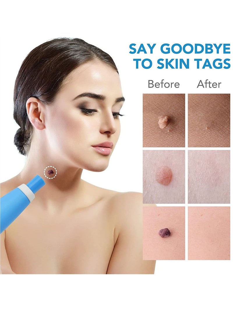 SYOSI - Skin Tag Remover, Auto Painless Skin Tag Remover Device for Small to Large Sized Skin Tags (2mm-8mm), Easy Application Device to Remove Skin Tags in Minutes - Image 1
