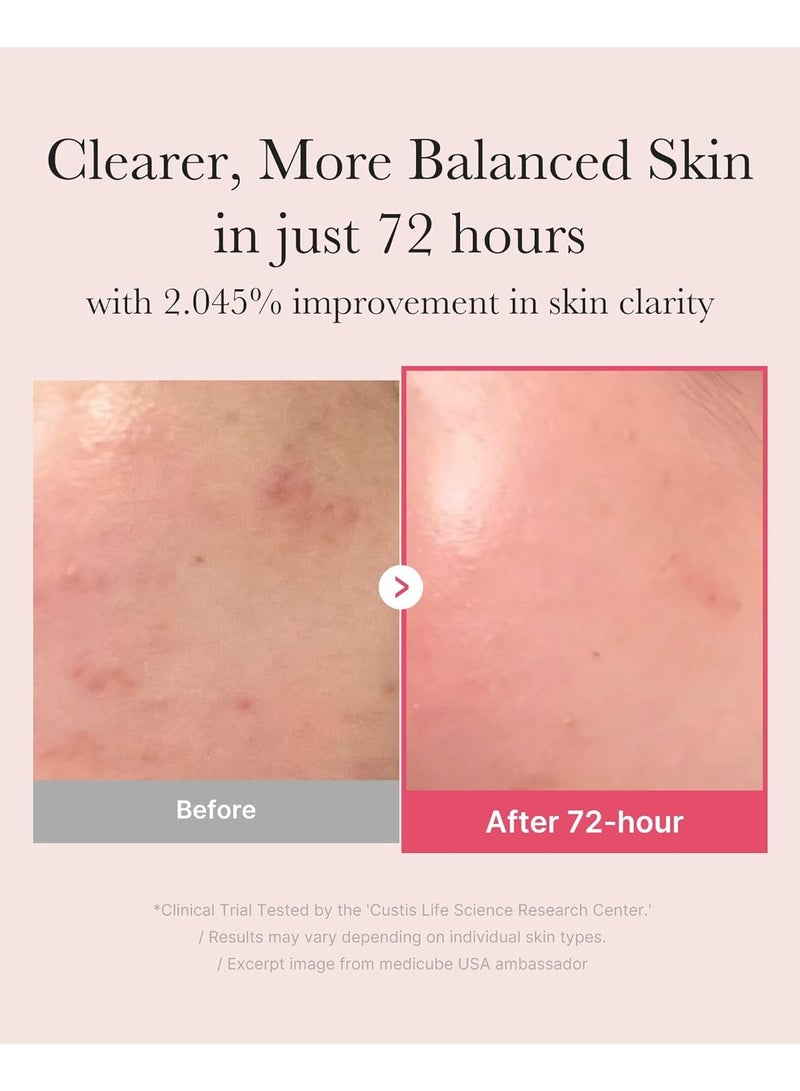 Medicube TXA+Niacinamide 15% Glow Facial Seurm for After Spot Care | All-in-One Daily Korean Skincare | Uneven Skin Tone, Texture, and Hydration Care | High-Potency Tranexamic Acid 5% | 1.01 fl.oz - Image 2