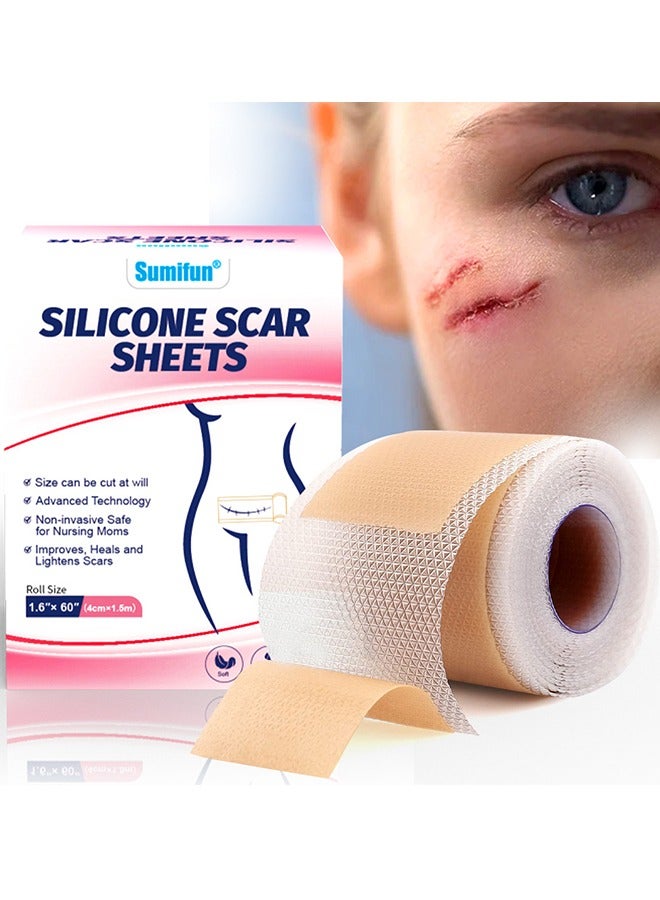 سوميفون شريط السيليكون الناعم لدرجة عالية من الراحة وغير مؤلم 6-8 أشهر تزويد حب الشباب ندبة C-قطاع جراحة الندبة الندبة المستشفى عالي المستوى الطبي (4cm x 150cm) - Image 1
