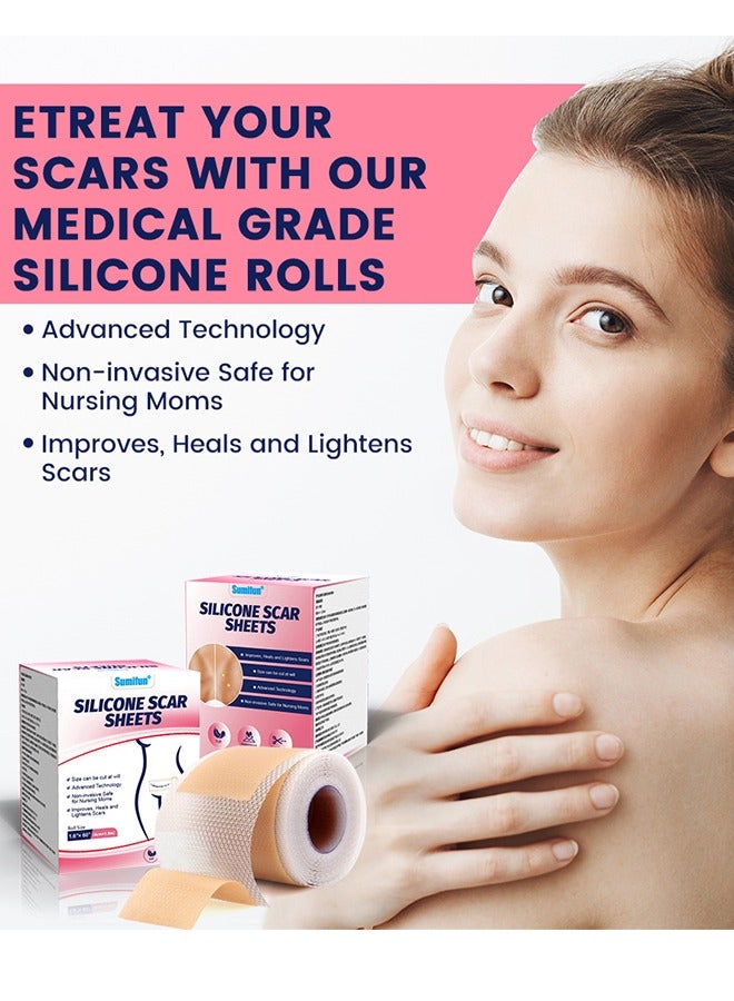 سوميفون شريط السيليكون الناعم لدرجة عالية من الراحة وغير مؤلم 6-8 أشهر تزويد حب الشباب ندبة C-قطاع جراحة الندبة الندبة المستشفى عالي المستوى الطبي (4cm x 150cm) - Image 3