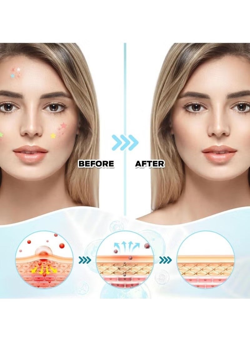 جايسوينغ 200 Pcs Pimple Patches, Hydrocolloid Acne Patches for Face, Colorful Star Pimple Spot Sticker with Hyaluronic Acid, Tea Tree Oil&Centella Oil for Covering Zits and Blemishes - Image 3