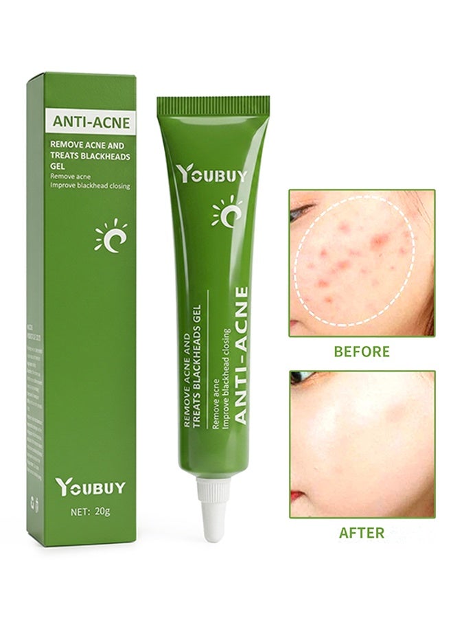 Youbuy جل لإزالة حب الشباب وعلاج الرؤوس السوداء للاستخدام اليومي يزيل حبوب الوجه ويعالج الرؤوس السوداء بحمض الأزيليك، يتحكم في الزيت، يقلص المسام، يخفف الاحمرار، يفتح البشرة، كريم لتلاشي الندوب وكريم مزيل حب الشباب 20 غ - Image 1