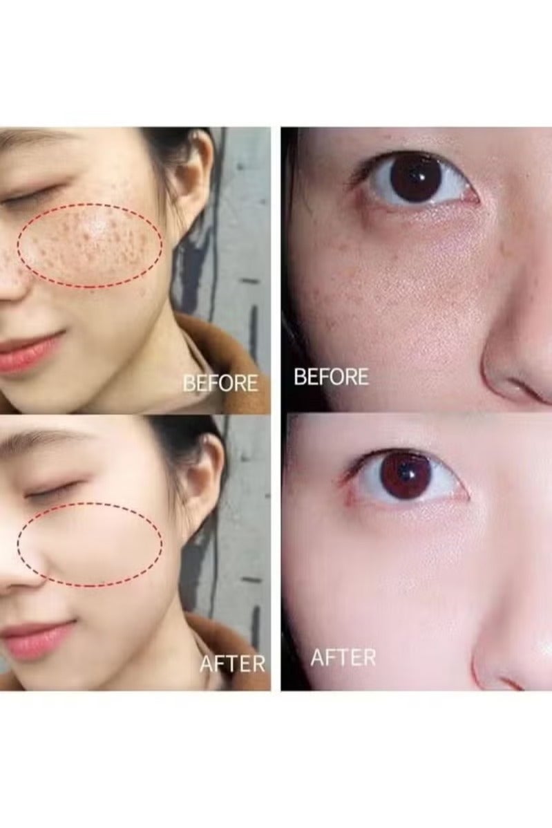 Lanthome Glutathione White Cream Facial Dark Spots Remover 2% Glutathione Face Cream Whitening Moisturizing Facial Cream Face Moisturizer Facial Skin Care Cream Intensive Lightening Facial Cream 20g - Image 4