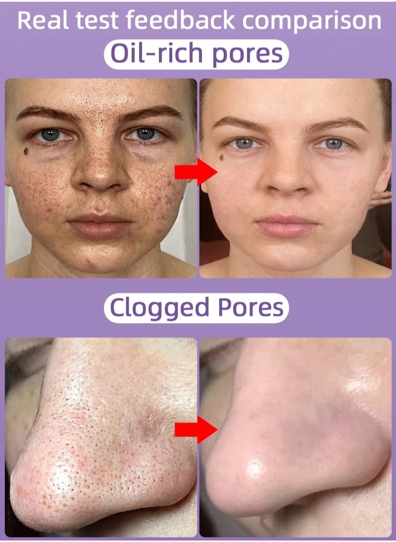 Pore - Pozoamis Refining Serum Shrink Pores, Repair  and Moisturizing and Smoothing Beautiful Skin 30ml - Image 1