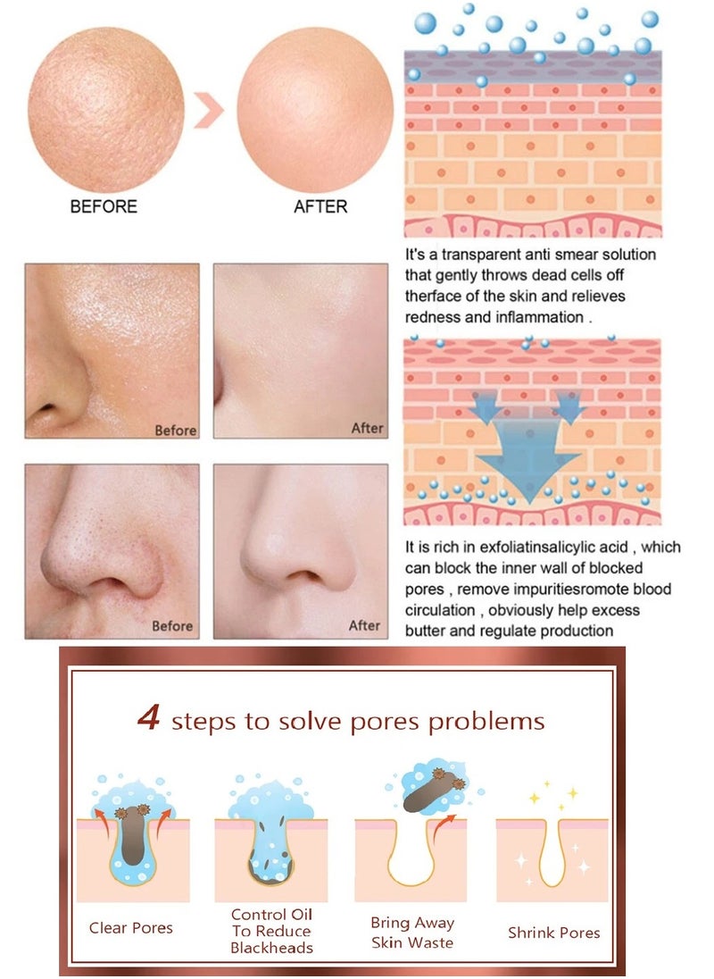 Pore - Pozoamis Refining Serum Shrink Pores, Repair  and Moisturizing and Smoothing Beautiful Skin 30ml - Image 1