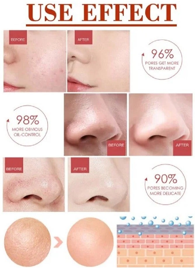 Pore - Pozoamis Refining Serum Shrink Pores, Repair  and Moisturizing and Smoothing Beautiful Skin 30ml - Image 1