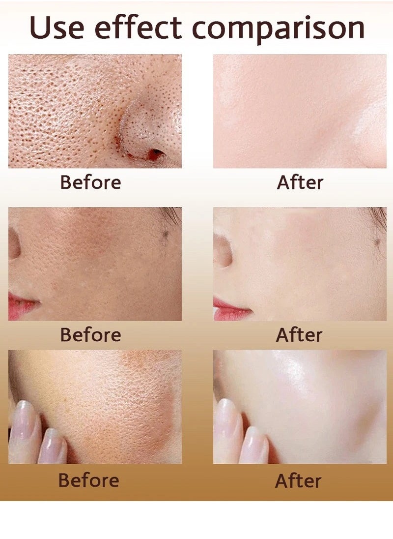 Pore - Pozoamis Refining Serum Shrink Pores, Repair  and Moisturizing and Smoothing Beautiful Skin 30ml - Image 1