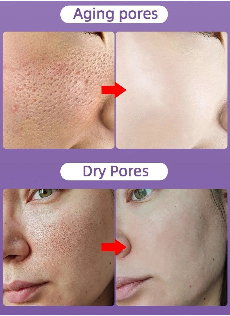 Pore - Pozoamis Refining Serum Shrink Pores, Repair  and Moisturizing and Smoothing Beautiful Skin 30ml - Image 1