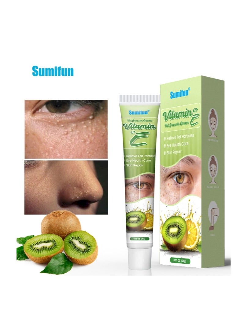 سوميفون حبيبات الدهون ثؤلول الدهون مزيل حبوب الشحوم مرهم تتلاشى الهالات السوداء العناية بالعيون كريم عشبي مضاد للانتفاخ جوهر ترطيب - Image 1