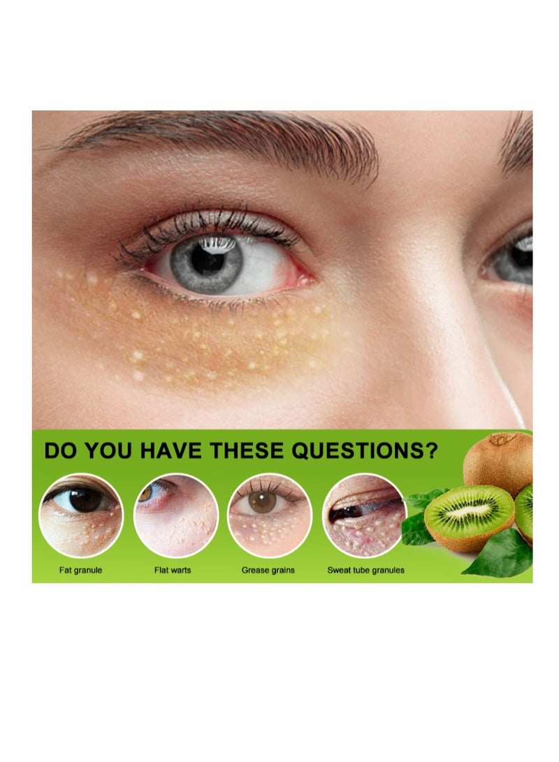 سوميفون حبيبات الدهون ثؤلول الدهون مزيل حبوب الشحوم مرهم تتلاشى الهالات السوداء العناية بالعيون كريم عشبي مضاد للانتفاخ جوهر ترطيب - Image 2