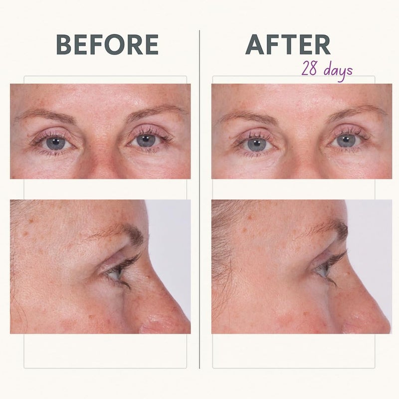 Serious Skincare Reverse Lift Tightening Eye Cream with Peptides, Hydrating Anti-Aging, Temporarily Lift Eyelids, Eyebrow, Under Eye Skin Firming Wrinkle Formula, Women, Men,1 Fl. Oz. - Image 4