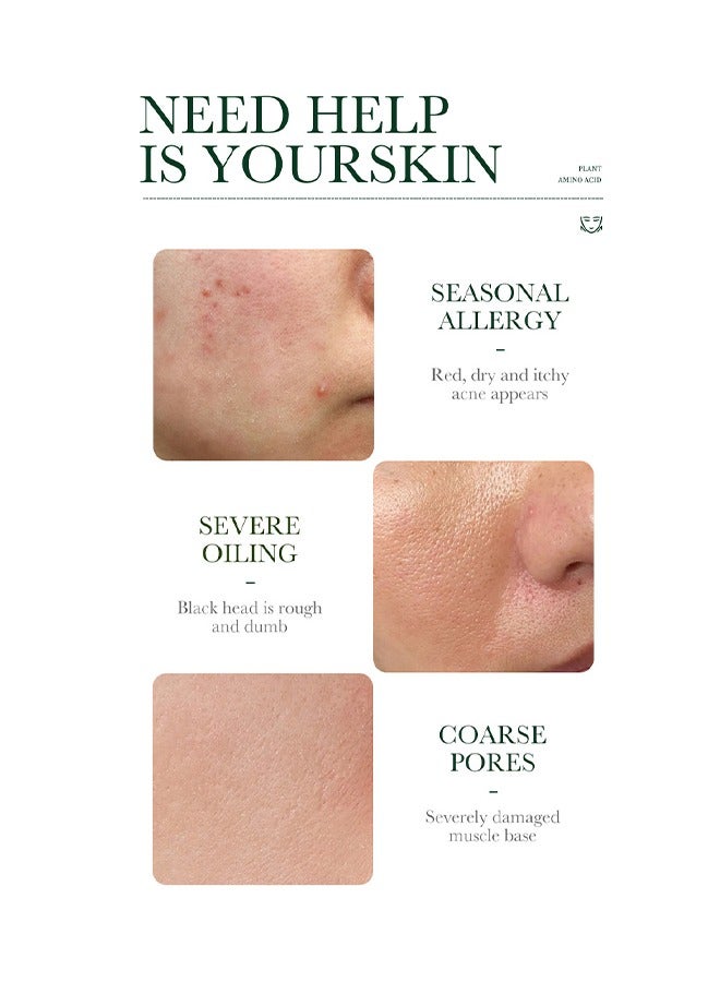 BIOAQUA Pure Skin Acne Treatment Scar Removal Cream,Acne Spot Treatment for Face & Acne Dots, Natural Cystic Acne Treatment, For All Skin Types, Premium Acne Scar Cream & Pimple Remover - 30grams  - Image 3