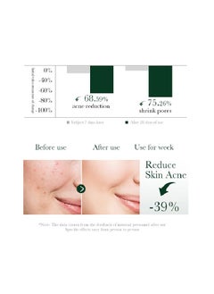 BIOAQUA Pure Skin Acne Treatment Scar Removal Cream,Acne Spot Treatment for Face & Acne Dots, Natural Cystic Acne Treatment, For All Skin Types, Premium Acne Scar Cream & Pimple Remover - 30grams  - Image 4