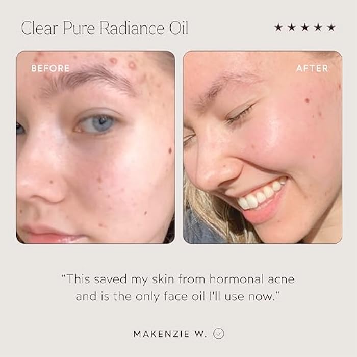 True Botanicals Clear Pure Radiance Oil | Oily Skin Types | Anti-Aging Face Oil for Acne Prone Skin | Treats Fine Lines & Wrinkles | Dermatologist Tested, All Natural, Vegan | 1 fl oz | 30 ml - Image 4