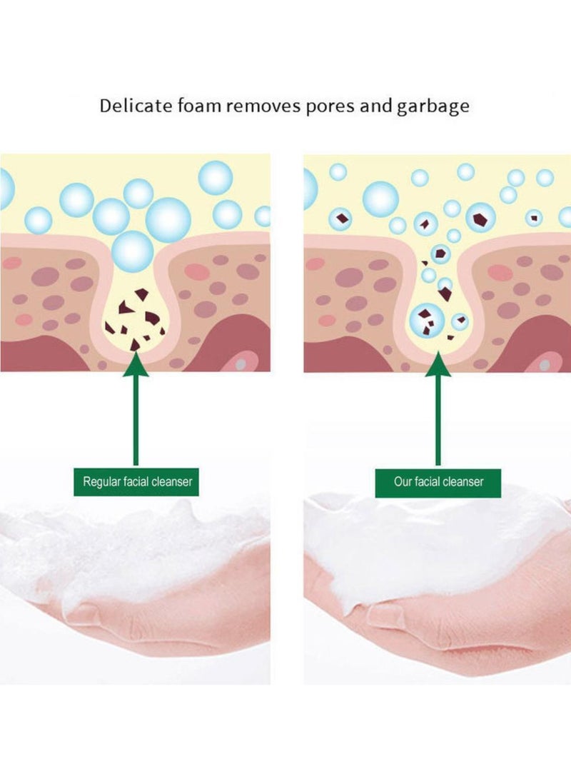 KANGYUAN منظف الوجه لتحسين البقع والتبييض، منظف عميق لتبييض الوجه من كويشيفان، منظف رغوي للوجه، سعة كبيرة - Image 4