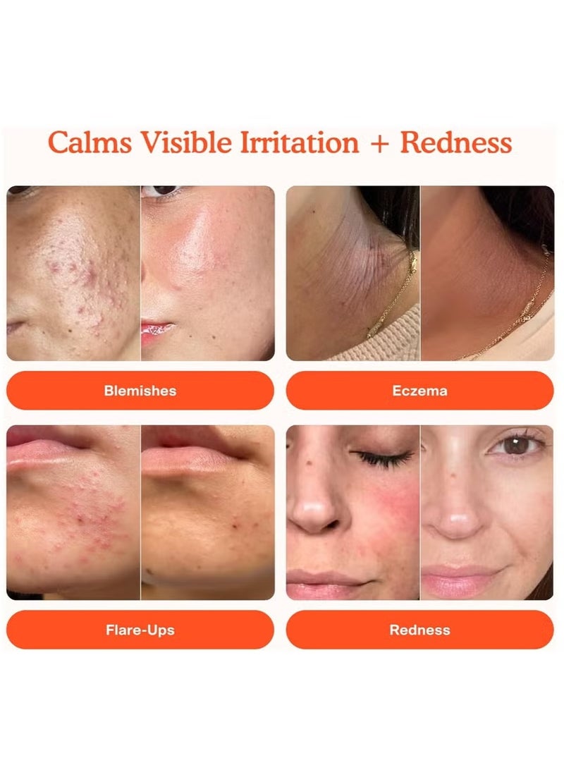 Tower 28 SOS Daily Rescue Facial Spray - The Miracle pH - Balancing Toner! Hypochlorous Acid Formula for Ultra - Sensitive Skin, 4 Fl Oz - Image 2