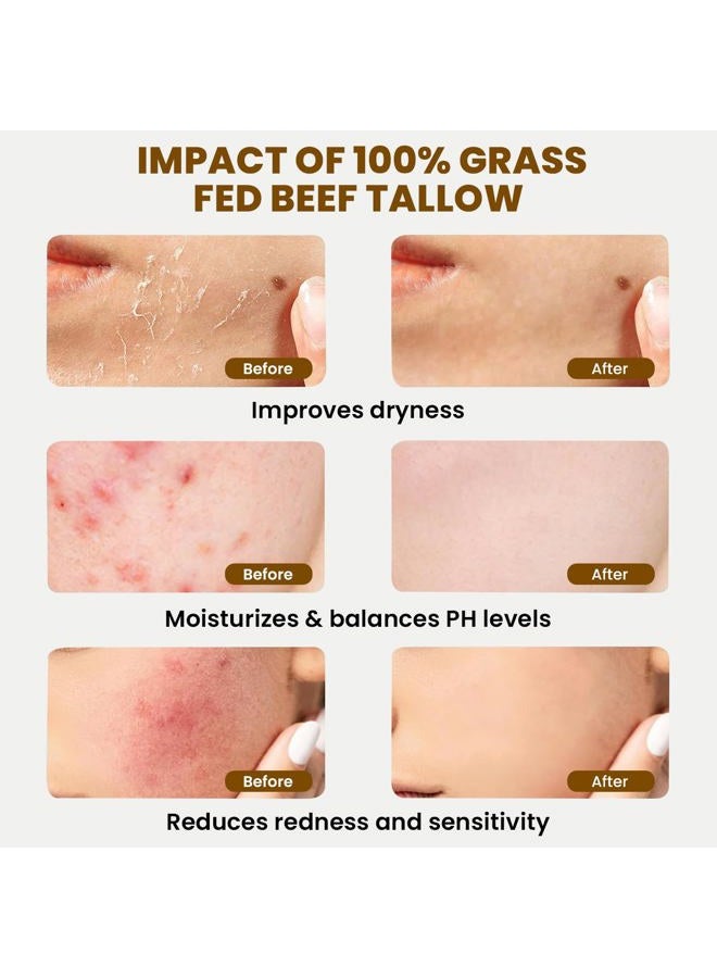 MONIER Whipped Beef Tallow for Skin, Tallow and Honey Balm for Face, Moisturizer with 100% Organic Grass-Fed Beef Tallow & Raw Wild Honey - Packaging May Vary - Dry & Sensitive Skin (Unscented) - Image 2