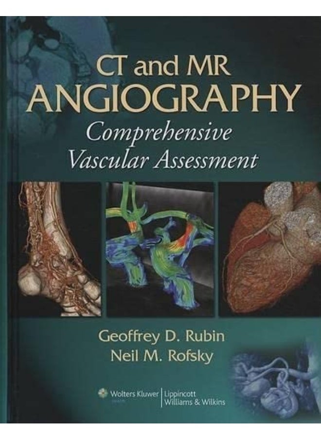 null - CT and MR Angiography: Comprehensive Vascular Assessment - Image 1