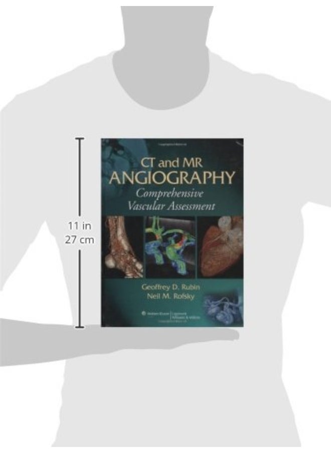null - CT and MR Angiography: Comprehensive Vascular Assessment - Image 1