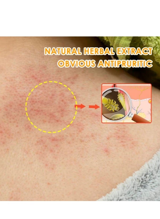 سوميفون كريم بصيلات الشعر، بصيلات شعر فروة الرأس وبصيلات الشعر المصابة بحب الشباب، علاج للوجه والجسم، علاج طبيعي لحب الشباب الكيسي، كريم بصيلات الشعر الفاخر ومزيل البثور - 20 جرام - Image 3