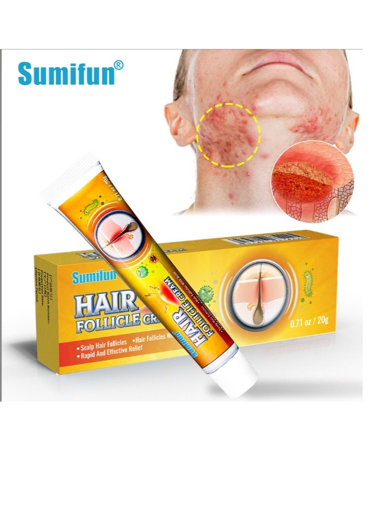 سوميفون كريم بصيلات الشعر، بصيلات شعر فروة الرأس وبصيلات الشعر المصابة بحب الشباب، علاج للوجه والجسم، علاج طبيعي لحب الشباب الكيسي، كريم بصيلات الشعر الفاخر ومزيل البثور - 20 جرام - Image 1