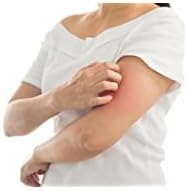 Globe مرهم هيدروكورتيزون شفاف بقوة قصوى من جلوب 4 عبوات 11 أونصة مرهم موضعي مضاد للحكة للاحمرار والتورم والحكة والطفح الجلدي ولدغات الحشرات والبعوض والأكزيما والبواسير والمزيد - Image 5