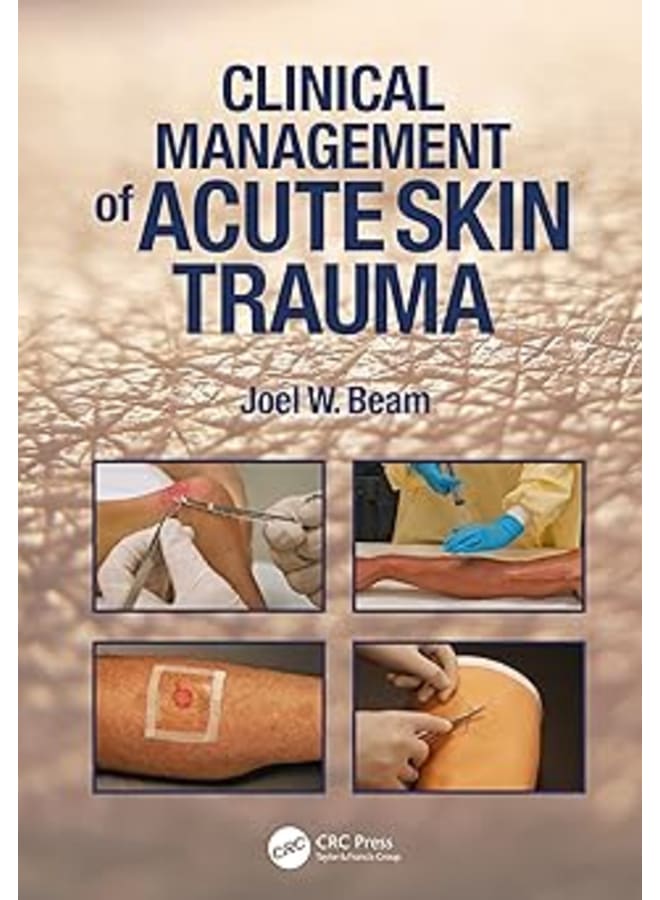 Clinical Management of Acute Skin Trauma